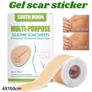 150cm Silicone Gel Scar Sheet Patch Treatment Removal Tape Acne Trauma Burn Scar Cover Skin Repair Section Ear Beauty