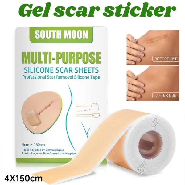 150cm Silicone Gel Scar Sheet Patch Treatment Removal Tape Acne Trauma Burn Scar Cover Skin Repair Section Ear Beauty