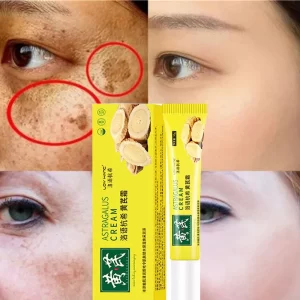 Astragalus Whitening Cream Freckles Remove Melasma Fade Dark Spot Dark Yellow Skin Brighten Anti-aging Moisturize Face Skin Care