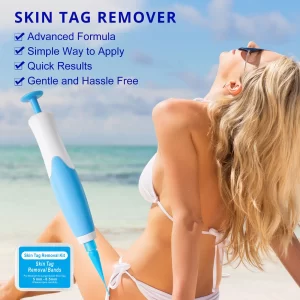 1 Set Auto Skin Tag Remover 2-8mm Band Painless Mole Wart Skin Tag Removal Pen Wart Dot Corn Treatments Body Facial Beauty Tool