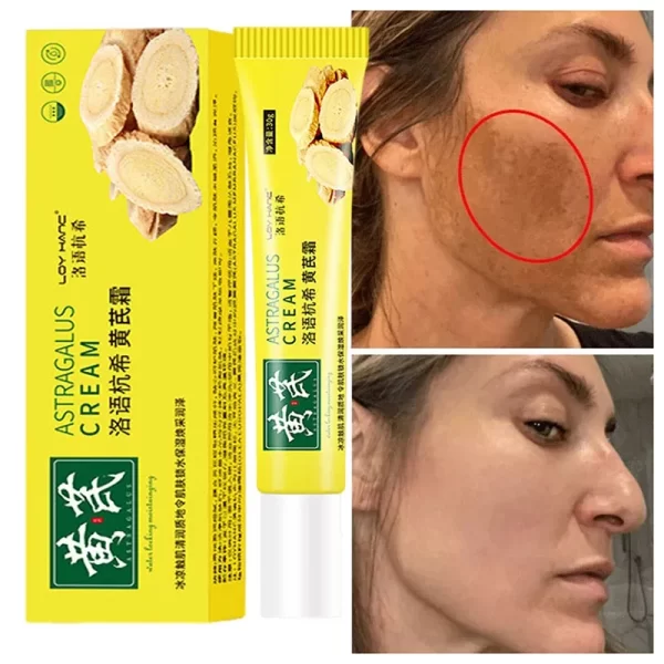 Astragalus Whitening Cream Freckles Remove Melasma Fade Dark Spot Dark Yellow Skin Brighten Anti-aging Moisturize Face Skin Care - Image 2