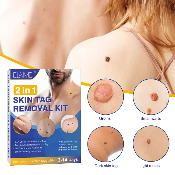 1 Set Auto Skin Tag Remover 2-8mm Band Painless Mole Wart Skin Tag Removal Pen Wart Dot Corn Treatments Body Facial Beauty Tool - Image 4