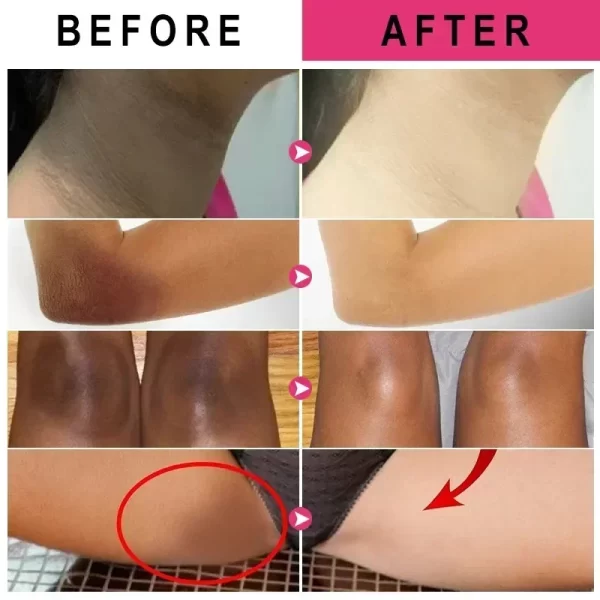 Vitamin C Brighten Cream Bleaching Armpits Elbows Knees Brightening Skin Cream Moisturizing Body Lotion Cream Lightening Melanin - Image 4