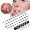 4Pcs Blackhead Acne Remover Set Beauty Skin Care Pore Cleaner Acne Needle Pimple Stainless Steel Pimple Needles Removal Tools - Image 2
