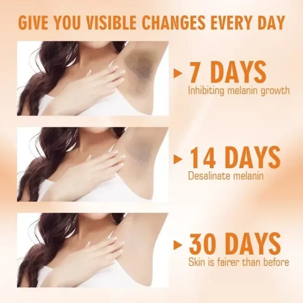 Vitamin C Brighten Cream Bleaching Armpits Elbows Knees Brightening Skin Cream Moisturizing Body Lotion Cream Lightening Melanin - Image 5
