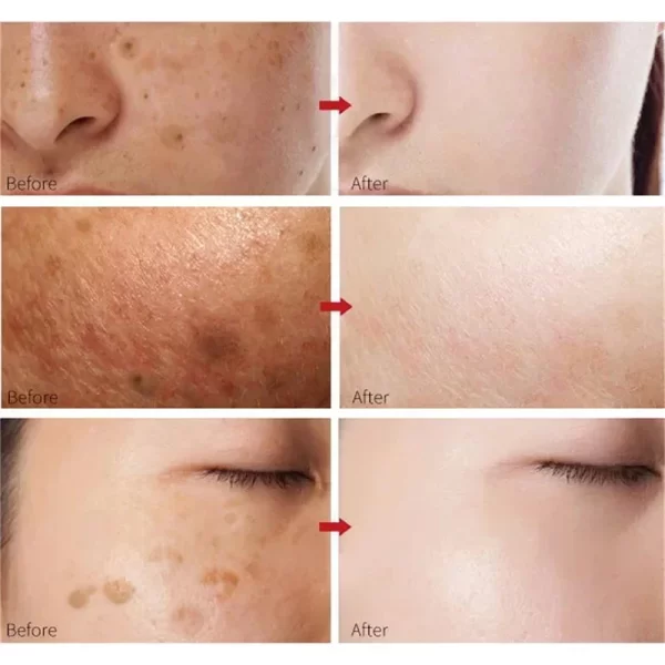 White Rice Whitening Face Cream Remove Dark Spots Fade Freckle Melanin Anti Wrinkle Aging Moisturizing Brighten Skin Care New - Image 4