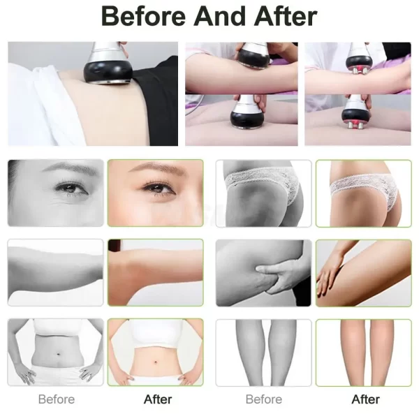 40K 4IN1 Cavitation Ultrasonic Body Slimming Machine RF Beauty Device Facial Massager Care Tool Skin Tighten Face Lifting Skin - Image 8