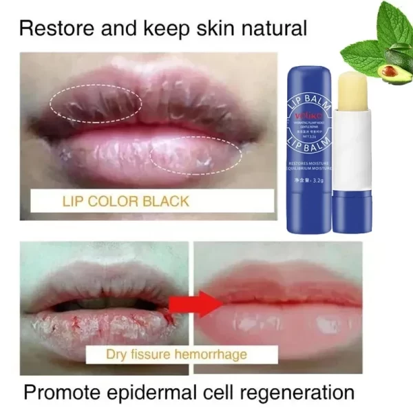 Lip Balm Remove Dark Lighten Melanin Lip Mask Fade Lip Line Brighten Exfoliating Moisturize Dead Skin Repair Lip Care Products - Image 3