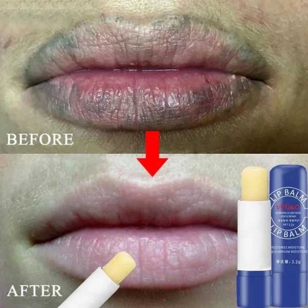 Lip Balm Remove Dark Lighten Melanin Lip Mask Fade Lip Line Brighten Exfoliating Moisturize Dead Skin Repair Lip Care Products - Image 4