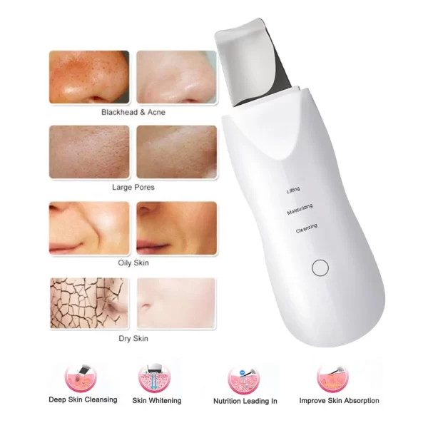 Facial Vibration Massage Skin Scrubber Cleaner Ion Acne Blackhead Remover Peeling Shovel Cleaner Facial Massager Skin Care - Image 2