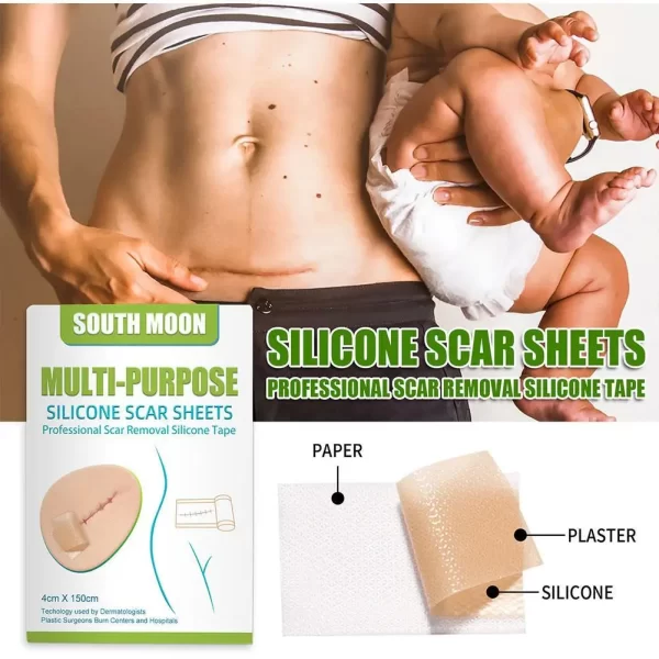 150cm Silicone Gel Scar Sheet Patch Treatment Removal Tape Acne Trauma Burn Scar Cover Skin Repair Section Ear Beauty - Image 5
