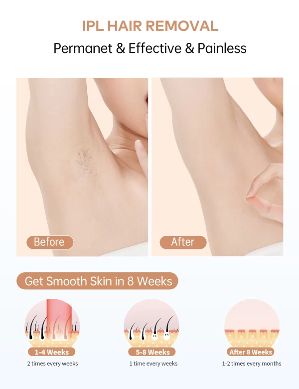 Professional IPL Hair Removal Laser 999900 Flashes Painless Pulsed Light Epilator HR/RA/SC 3 in 1 Whole Body Treament Home Use - Image 3