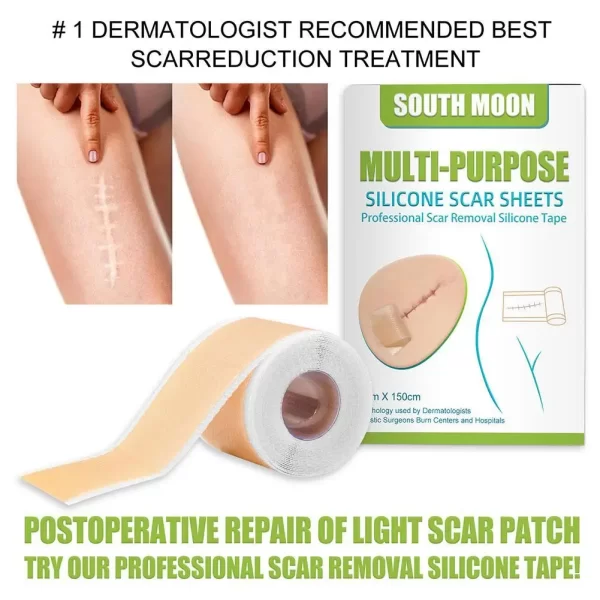 150cm Silicone Gel Scar Sheet Patch Treatment Removal Tape Acne Trauma Burn Scar Cover Skin Repair Section Ear Beauty - Image 6