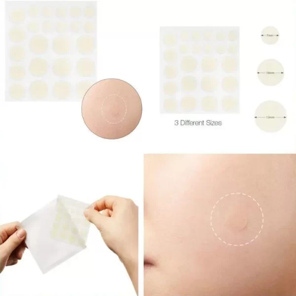 24pcs Face Acne Pimple Spot Facial Skin Care Blackhead Removal Freckle Patches Scar Care Treatment Stickers Acne Mask Beauty - Image 2