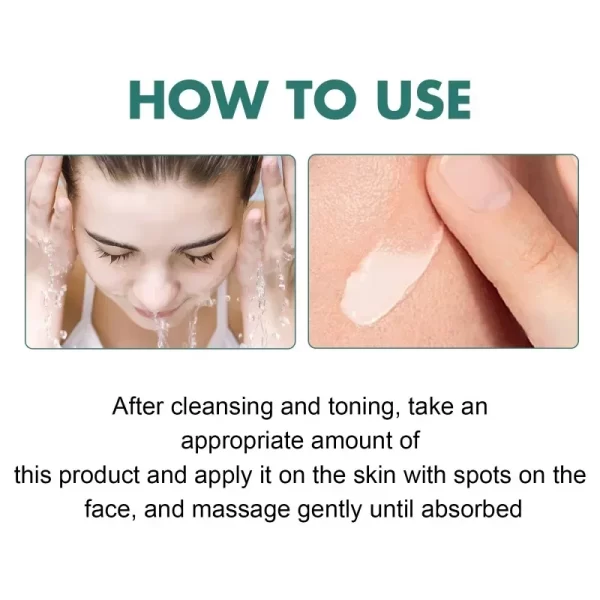 eelhoe Niacinamide Melasma Brightening Cream Reduce Melanin Brighten Cream Lighten Dark Skin Chloasma Serum Fade Fine Face Lines - Image 3
