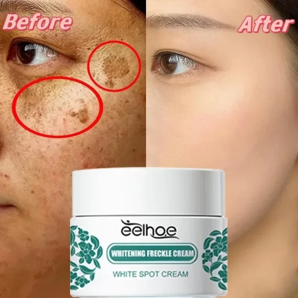 eelhoe Niacinamide Melasma Brightening Cream Reduce Melanin Brighten Cream Lighten Dark Skin Chloasma Serum Fade Fine Face Lines - Image 2
