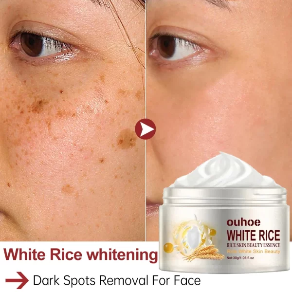 White Rice Whitening Face Cream Remove Dark Spots Fade Freckle Melanin Anti Wrinkle Aging Moisturizing Brighten Skin Care New - Image 3