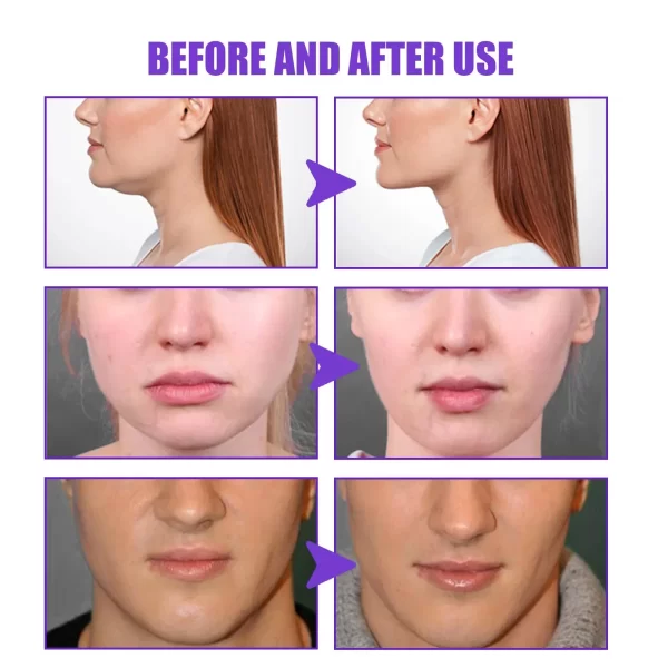 Hot V-Shape Slimming Cream Removal Double Chin Firming Tighten Mandibular line Slimming Masseter Face Muscle Fat Burning Cream - Image 4
