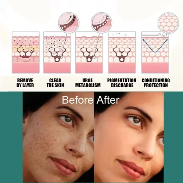 eelhoe Niacinamide Melasma Brightening Cream Reduce Melanin Brighten Cream Lighten Dark Skin Chloasma Serum Fade Fine Face Lines - Image 5