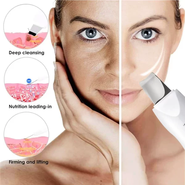 Facial Vibration Massage Skin Scrubber Cleaner Ion Acne Blackhead Remover Peeling Shovel Cleaner Facial Massager Skin Care - Image 3