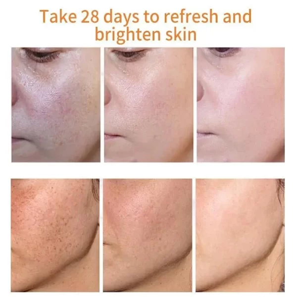 Astragalus Whitening Cream Freckles Remove Melasma Fade Dark Spot Dark Yellow Skin Brighten Anti-aging Moisturize Face Skin Care - Image 3