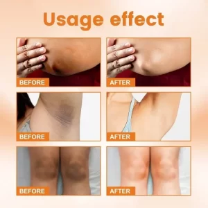 Vitamin C Brighten Cream Bleaching Armpits Elbows Knees Brightening Skin Cream Moisturizing Body Lotion Cream Lightening Melanin