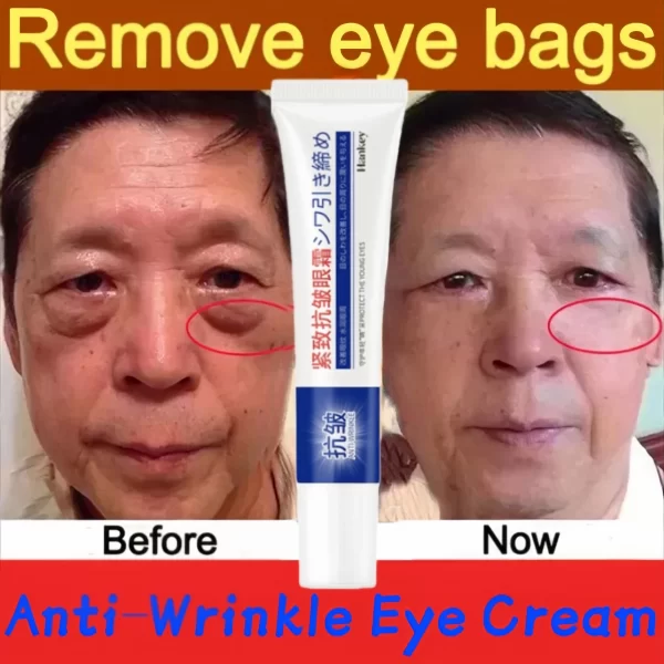 Retinol Anti-wrinkle Eye Cream Remove Eye Bags Dark Circles Fade Fine Lines Anti-Aging Puffiness Firm Brighten Firming Eye Care - Image 2