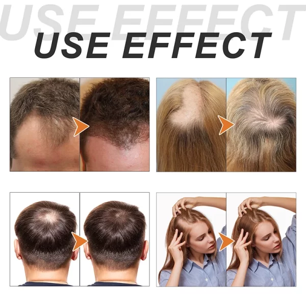 Onion Biotin Rosemary Shampoo Care Set Shampoo Conditioner For All Hair Types Hair Care Shampoo Treatment Silicone Free Shampoo - Image 3