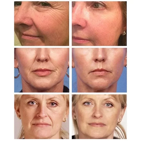 Instant Remove Wrinkle Serum Firming Lifting Anti-Aging Fade Fine Lines Improve Puffiness Moisturizing Brighten Face Skin Care - Image 3