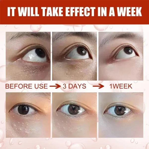 Fat Granules Remover Eye Cream Anti-Puffiness Anti Inflammatory Firm Cream Reduce Dark Circles Fade Fine Lines Repair Barrier Sk - Image 3