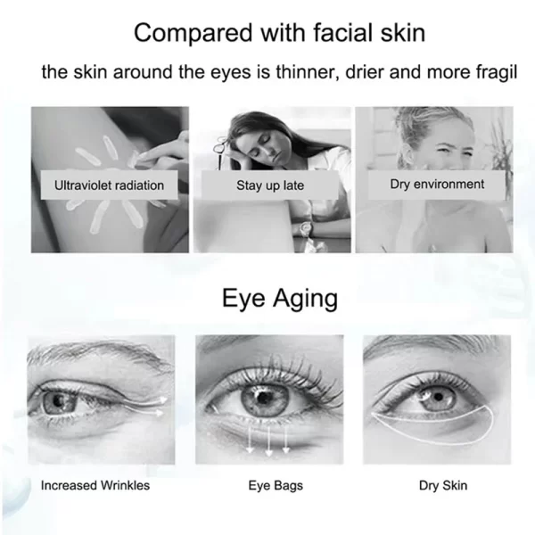 VEZE Nicotinamide Eyes Cream Dark Circles Remove Eye Bags Under Eye Acid Moisturizing Serum Against Puffiness Eye Care Gel - Image 5