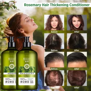Rosemary Hair Growth Shampoo with Mint Hair Loss for Women Men Thinning Hair Conditioner Hydrating,Volumizing Fights Dandruff