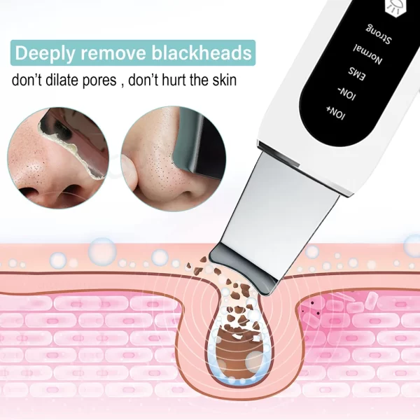 Ultrasonic Skin Scrubber Peeling Blackhead Remover Deep Face Cleaning Ultrasonic Ion Ance Pore Cleaner Facial Shovel Cleanser - Image 4