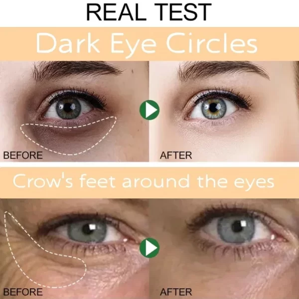 Instant Eye Bag Remove Eye Cream Anti Fat Particles Dark Circles Puffiness Fade Fine Lines Lift Brighten Korean Beauty Eye Care - Image 2