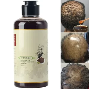 Africa Women Traction Alopecia Treatment Hair Loss Treatment Get Rid of Wigs Hair Growth Product for Men Shampoo 300ml Hair Care