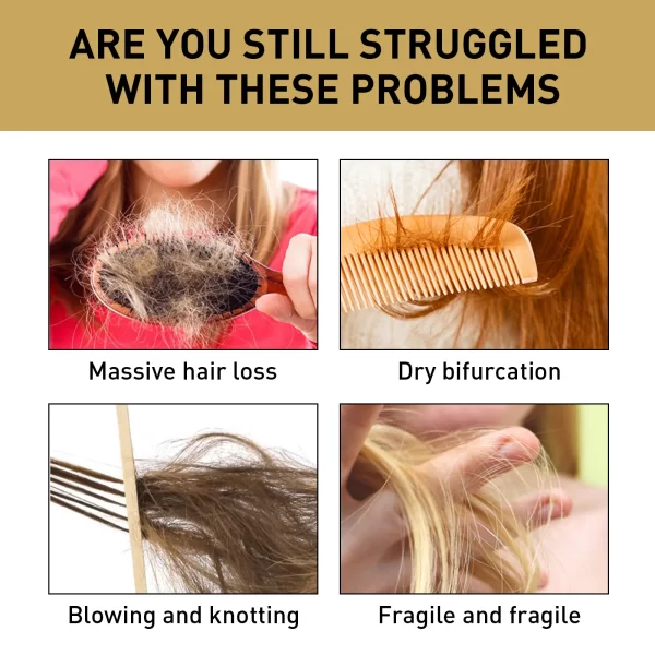 Hair Shampoo Ginger Promotes Hair Growth Dandruff Removal Anti-Itch Oil Control Nourishing Scalp Repair Frizzy Damaged Shampoo - Image 6
