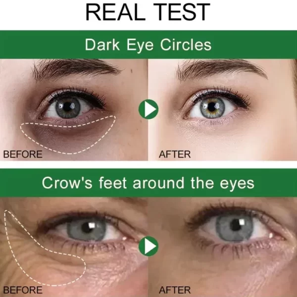Anti Dark Circles Bags Instant Remove Wrinkles Eye Cream Puffiness Fade Eye Fine Line Tighten Whiten Under Eyes Skin Care New - Image 4