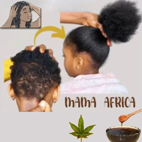 Africa Women Traction Alopecia Treatment Hair Loss Treatment Get Rid of Wigs Hair Growth Product for Men Shampoo 300ml Hair Care - Image 4