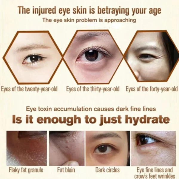 Fat Granules Remover Eye Cream Anti-Puffiness Anti Inflammatory Firm Cream Reduce Dark Circles Fade Fine Lines Repair Barrier Sk - Image 4