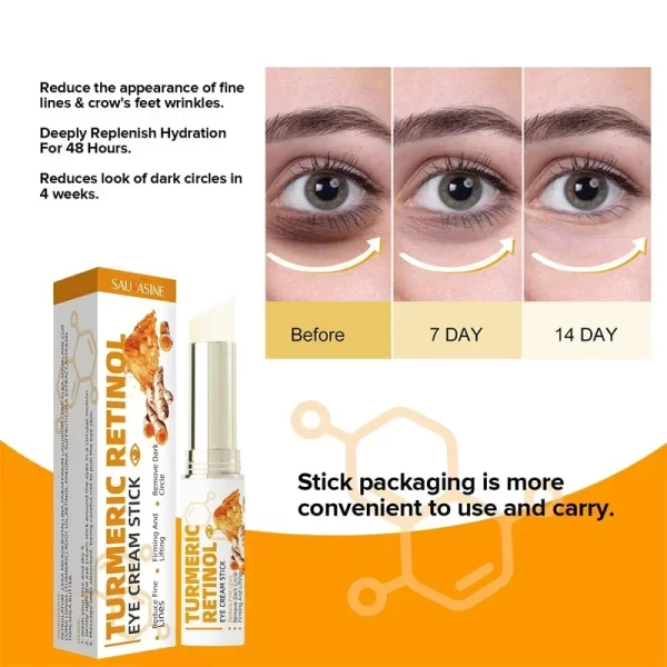 Instant Eye Bag Remove Eye Cream Anti Fat Particles Dark Circles Puffiness Fade Fine Lines Lift Brighten Korean Beauty Eye Care - Image 6