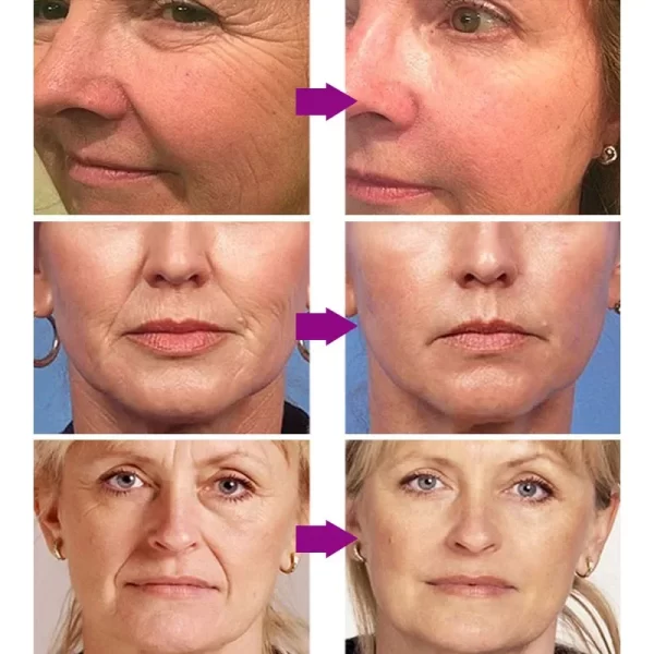 Original Remove Wrinkle Face Set Firming Lifting Anti-Aging Serum  Fade Fine Lines Eye stick Improve Puffiness Korean Skin Care - Image 4