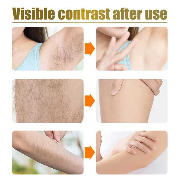 Pain Without Hair Removal Spray Woman Body Leg Privates Facial Hair Remover Men Hair Growth Inhibitors Mild Hair Removal 30ML - Image 3