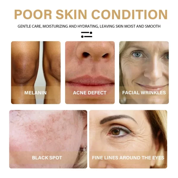 New Turmeric Oil Glow to Facial Lightening Brightening Serum For Black Brown Skin Leg Hand Body Whitening for Dark Skin 10/30ml - Image 4