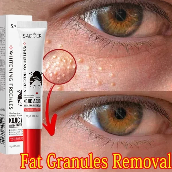 Fat Granules Remover Eye Cream Anti-Puffiness Anti Inflammatory Firm Cream Reduce Dark Circles Fade Fine Lines Repair Barrier Sk - Image 2