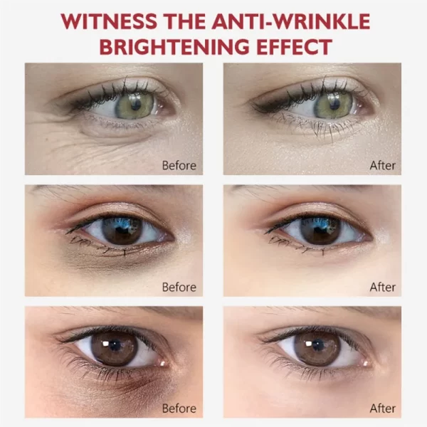 VEZE Nicotinamide Eyes Cream Dark Circles Remove Eye Bags Under Eye Acid Moisturizing Serum Against Puffiness Eye Care Gel - Image 3