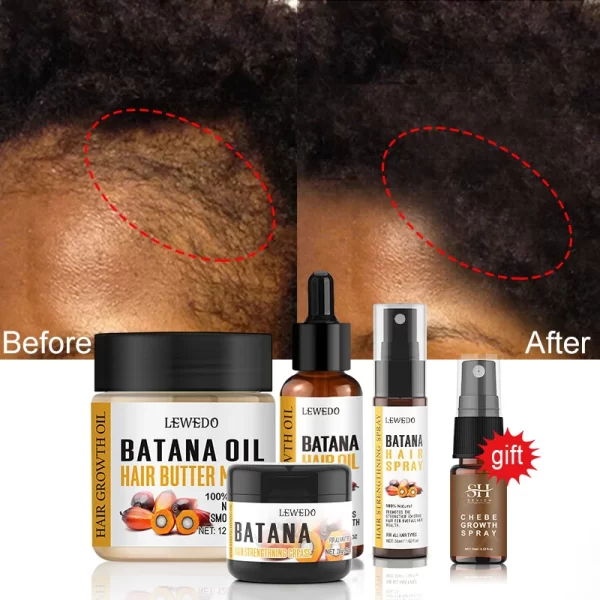Fast Hair Growth Oil Africa Crazy Traction Alopecia batana Hair Mask Anti Hair Break Hair Strengthener Hair Loss Treatment Spray - Image 2