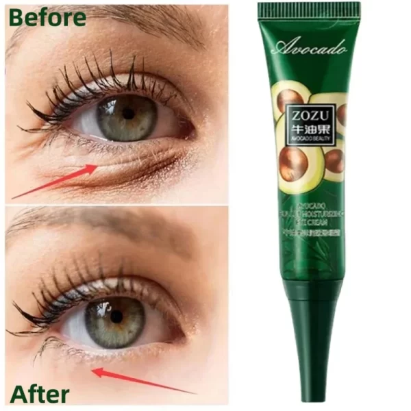 Anti Dark Circles Bags Instant Remove Wrinkles Eye Cream Puffiness Fade Eye Fine Line Tighten Whiten Under Eyes Skin Care New - Image 2
