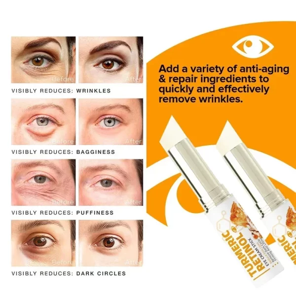 Instant Eye Bag Remove Eye Cream Anti Fat Particles Dark Circles Puffiness Fade Fine Lines Lift Brighten Korean Beauty Eye Care - Image 5