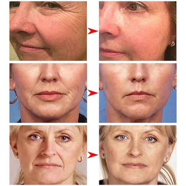 Instant Wrinkle Remover Face Cream Anti Aging Firming Lifting Fade Fine Lines Whitening Moisturizing Brighten Tighten Skin Care - Image 5