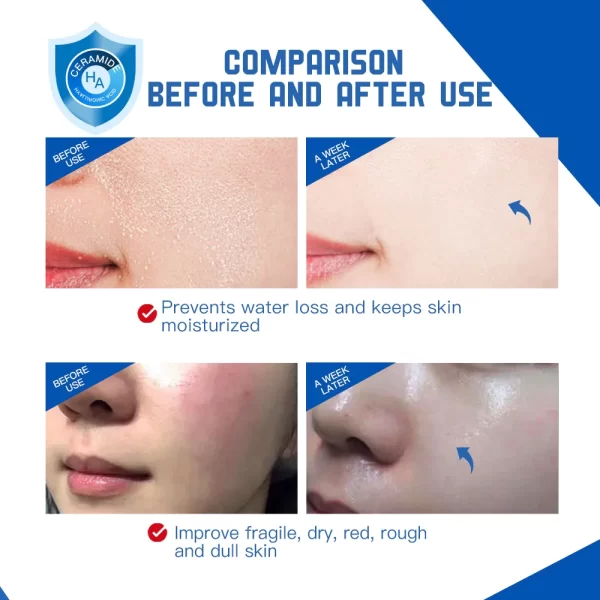Disaar Moisturizing Serum 50ml Hyaluronic Acid Ceramide Nicotinamide Essence Intensive Hydrating Fine Pore Brighten Skin Care - Image 5
